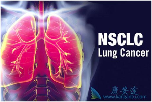 ��Сϸ���ΰ�