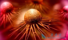 ��������Щ���Ƹ��ư�֢��PARP���Ƽ�����