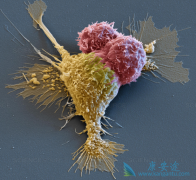 CAR-Tϸ�����յ��ѽ���ϸ���ڱ�������ܶȵ�CD20�İ�ϸ��