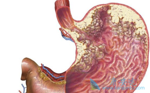 ���������˾�