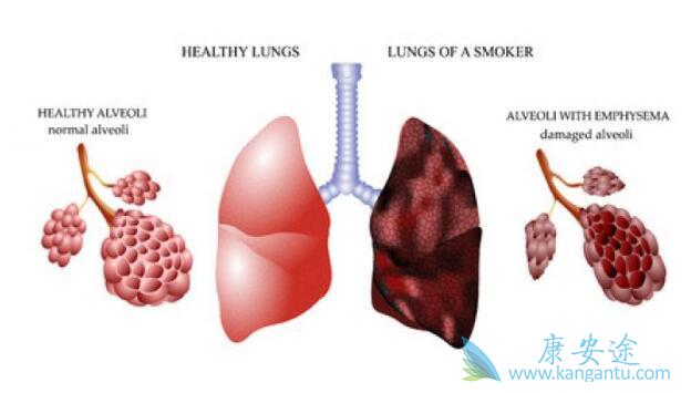 �ΰ����Ƹ�����