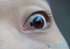 ����������BRAF���Ƽ����ƺ�ɫ������Ч����