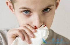 �����鵥��(Nimotuzumab)���ҹ����Ʊ��ʰ��ĺ���ҩ��