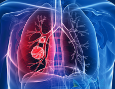 PD-1���ϻ���ҩ�������ض����ͷΰ�ʱ����50%�Ŀ͹ۻ�����