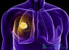 ����ҩ����������(Lorlatinib)��Ч�Կ��ΰ���ת��