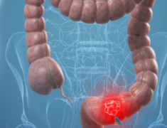 ��Ѫ��������ҩ�����ϻ�����ת���Խ�ֱ�������ߵ���Ҫ�����ֶ�