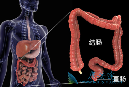 ��ֱ����