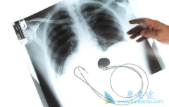 ��ϣ����Ͷ������������Ʒΰ�Ч�����к�����