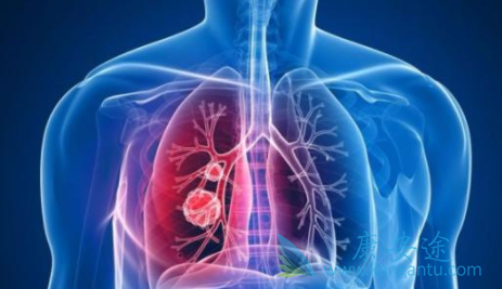 ��ҩ���Ʒΰ�