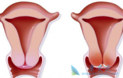 �������þ��β���Ҳ���������ڹ�����֢״����