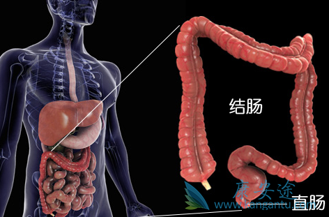 结直肠癌 结直肠癌