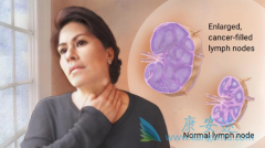 �ܰ�����Ҫ��Ϊ������ܰ�����ǻ�����ܰ���