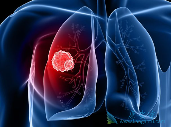 �ΰ�����