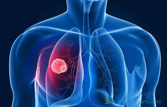 �ΰ�����