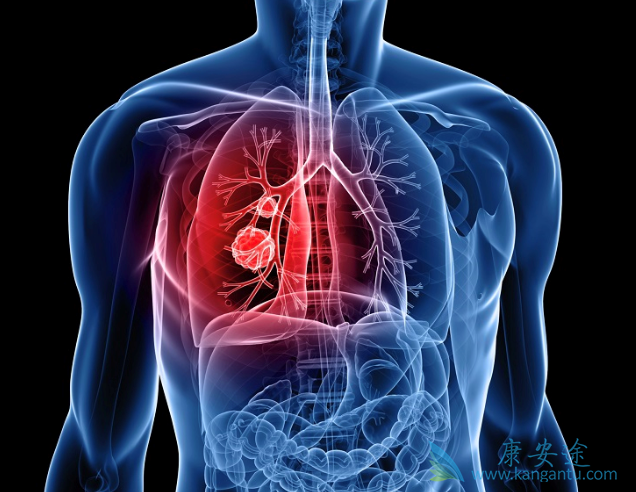 �ΰ�����