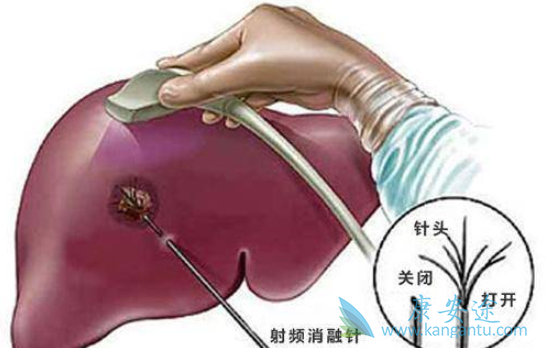 �Ҹ���ʲô��