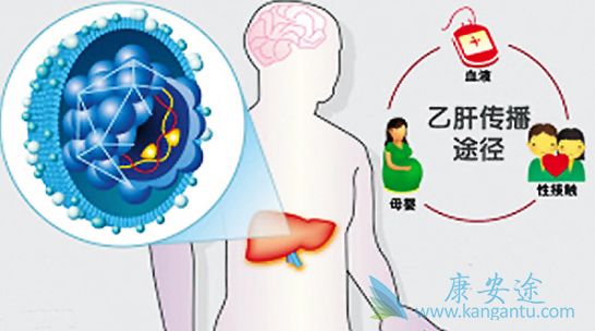 �Ҹ�Я���ߴ�Ⱦ��