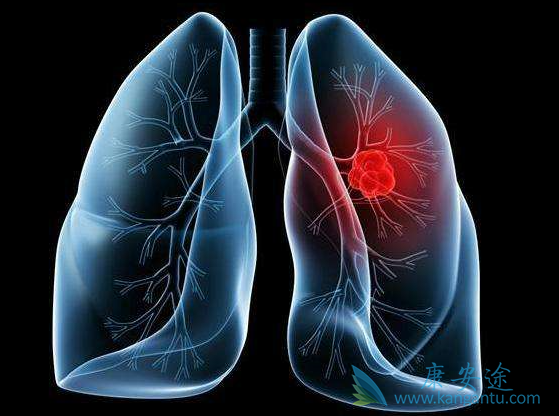 �ΰ�����