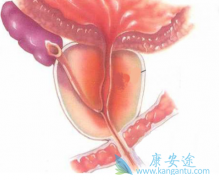 ǰ���ٰ����߽���ҩ��ȥ�����ƵĲ�����Ӧ����Щ��