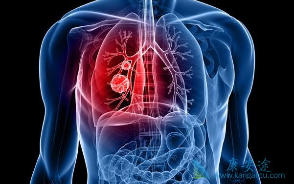 �ΰ���������