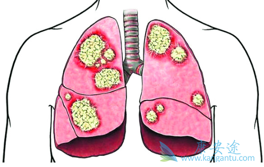 �ΰ���������