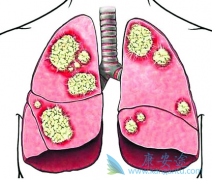 ��Сϸ���ΰ�������ô����Ч���ã�