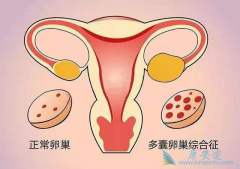 �ѳ�����֢״��ʲô���ѳ������Ի��ã�