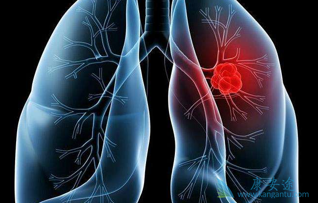 �ΰ���������