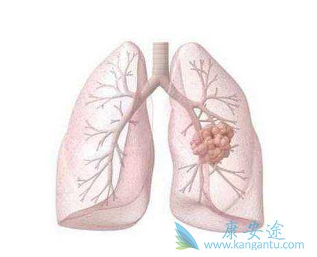 �ΰ���ת��