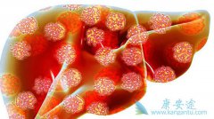 �Ҹο�������ʲô���Ҹ�������Ҫ����Ҫ������