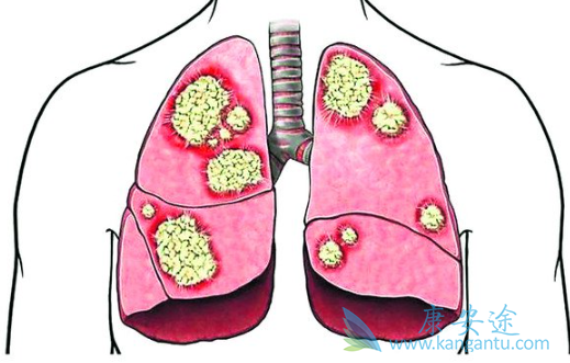 �ΰ�egfr�е�