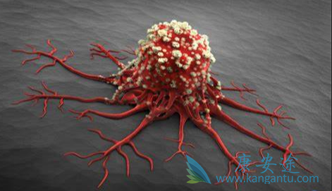 癌症的症状;乳腺癌 癌症的症状;乳腺癌