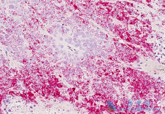 ���ٰ�������������ô���л��߲��ܻ�þã�