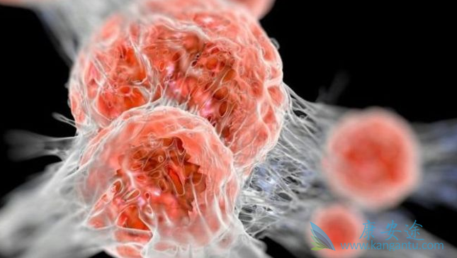 癌细胞转移;靶向治疗 癌细胞转移;靶向治疗