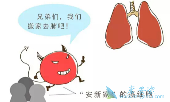 ��֢ת��;�ΰ���ת��