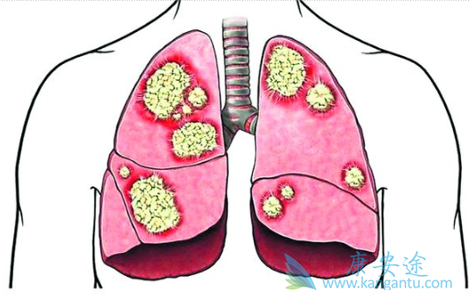 �ΰ���ת��