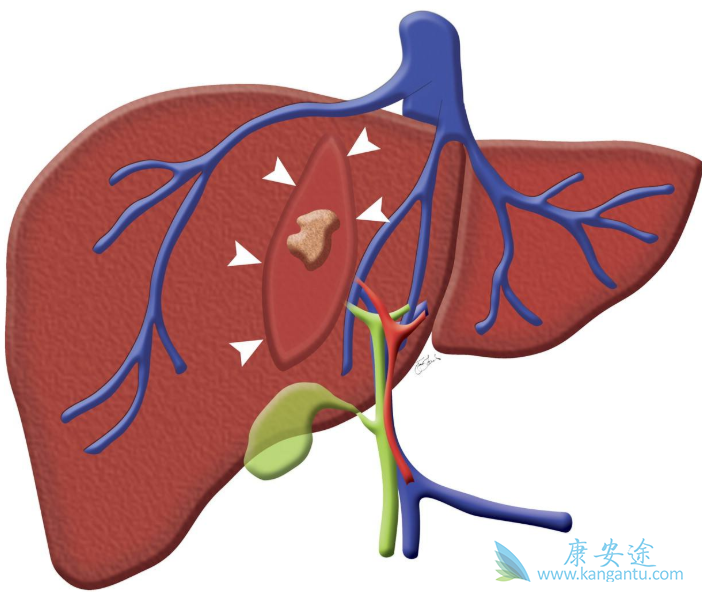 ���ο��Ա��κ���