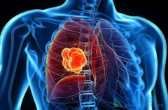 �ΰ�������ô���ƣ�����Щ�ΰ�������Чҩ��