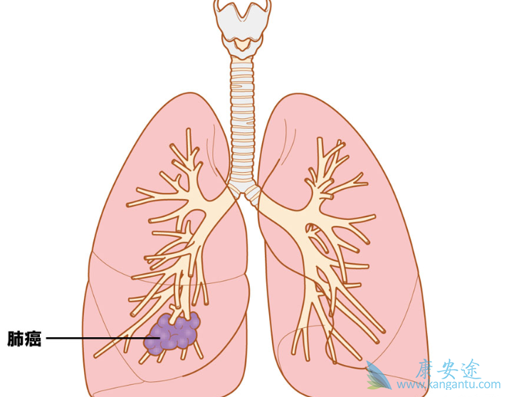 �ΰ�������;��Сϸ���ΰ�