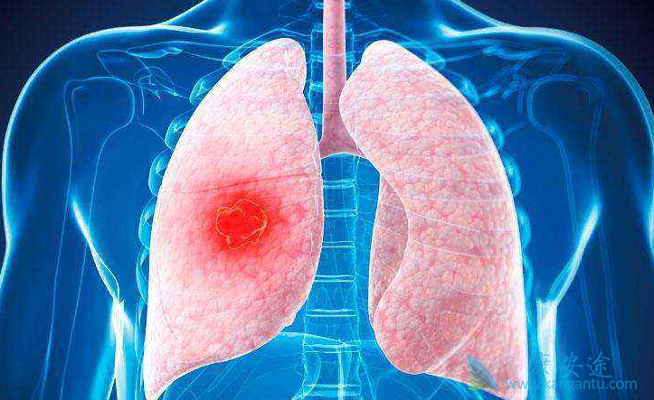 �ΰ�ҩ��;�ΰ�������