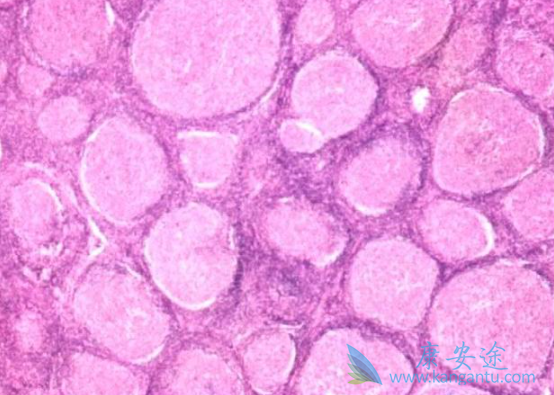 �ǻ�����ܰ���