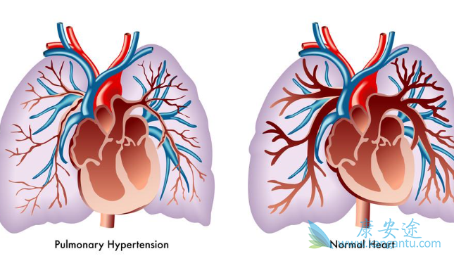 �ζ�����ѹ
