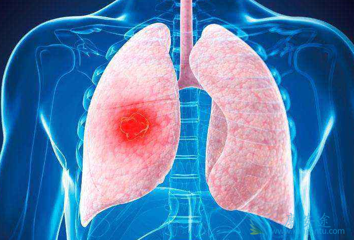 �ΰ�����;��������