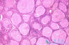 ��PD1���ƻ�����ܰ�����Ҫ����Ǯ��