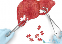 Ϊʲô�ܶ��˷�������ʱ�Ѿ����������ˣ���֢����Ҫ�����硱