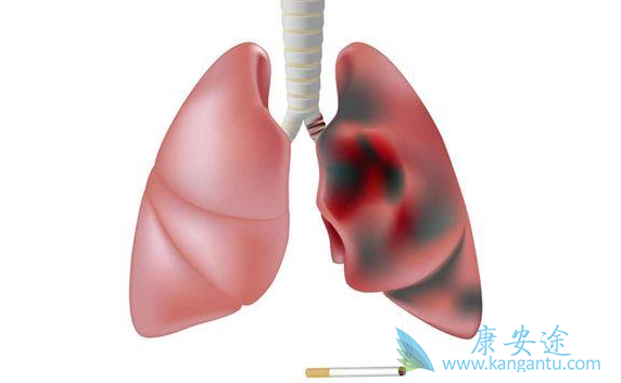 �ΰ�����;�ΰ�������