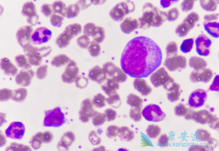 ��μ��ټ�����ϸ����Ѫ���ĸ�Ⱦ����֢��