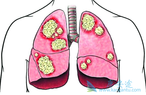 �ΰ�egfr�е�