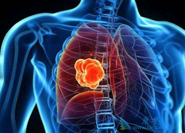 �ΰ��������κõ���