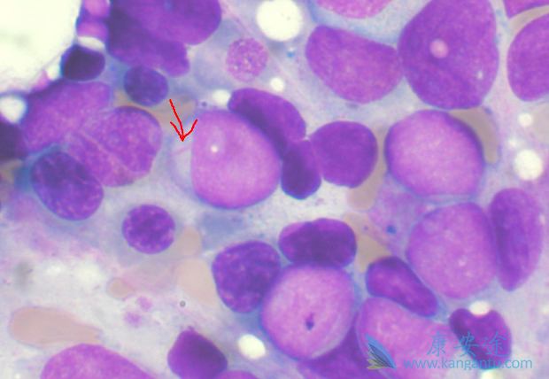 ������ϸ����Ѫ��